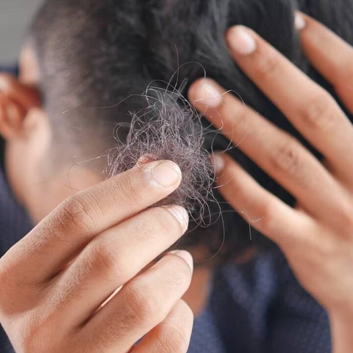 ਹਰ ਵਿਅਕਤੀ ਲਈ ਸਿਰ 'ਤੇ ਵਾਲ ਹੋਣਾ ਬਹੁਤ ਜ਼ਰੂਰੀ ਹੈ। ਇਸ ਨਾਲ ਤੁਹਾਡੀ ਪੂਰੀ ਦਿੱਖ ਬਦਲ ਜਾਂਦੀ ਹੈ ਅਤੇ ਤੁਸੀਂ ਸੁੰਦਰ ਦਿਖਾਈ ਦਿੰਦੇ ਹੋ। ਵਾਲਾਂ ਦੀ ਦੇਖਭਾਲ ਇੱਕ ਕੀਮਤੀ ਚੀਜ਼ ਵਾਂਗ ਕਰਨੀ ਪੈਂਦੀ ਹੈ। ਪਰ ਜਦੋਂ ਉਹੀ ਵਾਲ ਆਪਣੇ ਆਪ ਡਿੱਗਣ ਲੱਗਦੇ ਹਨ ਤਾਂ ਤਣਾਅ ਵਧਣਾ ਸ਼ੁਰੂ ਹੋ ਜਾਂਦਾ ਹੈ ਅਤੇ ਅਸੀਂ ਵੱਖ-ਵੱਖ ਤਰ੍ਹਾਂ ਦੇ ਉਤਪਾਦ ਵਰਤਣੇ ਸ਼ੁਰੂ ਕਰ ਦਿੰਦੇ ਹਾਂ।