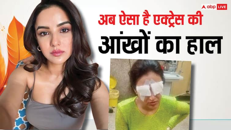 bigg boss fame jasmin bhasin show her eyes on Camera After Corneal Injury कॉन्टैक्ट लेंस लगाने से आंखें हुईं थी खराब, अब Jasmin Bhasin ने कैमरे के सामने आकर बताया कैसा है हाल