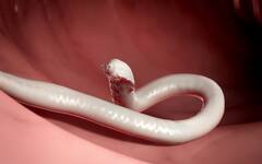 Stomach Worms: ਢਿੱਡ 'ਚ ਵੜ ਖੂਨ ਚੂਸ ਰਹੇ ਇਹ ਖਤਰਨਾਕ ਕੀੜੇ, ਜਾਣੋ ਕਿਵੇਂ ਬਣਾਉਣਦੇ ਸ਼ਿਕਾਰ