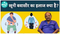 Piles: What Causes Hemorrhoids? | Hemorrhoid Treatment Explained | Health Live