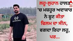 Shocking: ਲਹੂ-ਲੁਹਾਨ ਹਾਲਤ 'ਚ ਮਸ਼ਹੂਰ ਅਦਾਕਾਰ ਨੇ ਸ਼ੂਟ ਕੀਤਾ ਫਿਲਮ ਦਾ ਸੀਨ, ਵਗਦਾ ਰਿਹਾ ਲਹੂ, ਪਰ...