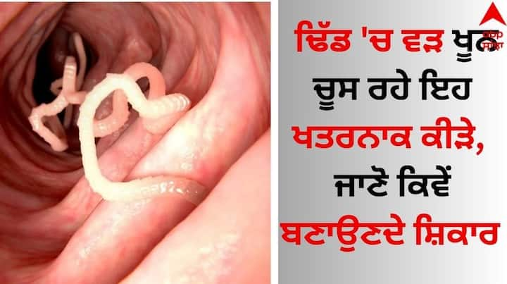 Stomach Worms: ਅੱਜਕੱਲ੍ਹ ਜਿਵੇਂ-ਜਿਵੇਂ ਪ੍ਰਦੂਸ਼ਣ ਵੱਧਦਾ ਜਾ ਰਿਹਾ ਹੈ, ਉਵੇਂ ਹੀ ਸਿਹਤ ਸਬੰਧੀ ਬਿਮਾਰੀਆਂ ਵੀ ਵੱਧਦੀਆਂ ਜਾ ਰਹੀਆਂ ਹਨ। ਇਸਦਾ ਜ਼ਿਆਦਾ ਪ੍ਰਭਾਵ ਬੱਚਿਆਂ ਉੱਪਰ ਪੈਂਦਾ ਹੈ।