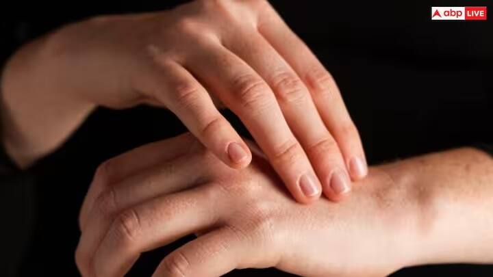 કળતર અને નિષ્ક્રિયતા: આંગળીઓ અથવા હાથમાં કળતર અને નિષ્ક્રિયતા આવી શકે છે. સામાન્ય રીતે અંગૂઠો, તર્જની, મધ્યમ અને રિંગ આંગળીઓને અસર થાય છે, પરંતુ નાની આંગળીને અસર થતી નથી. તમને આ આંગળીઓમાં ઈલેક્ટ્રીક શોક જેવું લાગે છે.