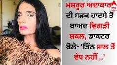 Shocking: ਮਸ਼ਹੂਰ ਅਦਾਕਾਰਾ ਦੀ ਸੜਕ ਹਾਦਸੇ ਤੋਂ ਬਾਅਦ ਵਿਗੜੀ ਸ਼ਕਲ, ਡਾਕਟਰ ਬੋਲੇ- 'ਤਿੰਨ ਸਾਲ ਤੋਂ ਵੱਧ ਨਹੀਂ...'