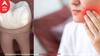Dentist ਨੇ 4 ਸਾਲ ਤੱਕ ਨਹੀਂ ਦਿੱਤੀ Appointment, ਸ਼ਰਾਬ ਪੀਤੀ, ਫਿਰ ਹਥੌੜੀ ਨਾਲ ਖੁਦ ਹੀ ਕੱਢ ਲਿਆ ਦੰਦ