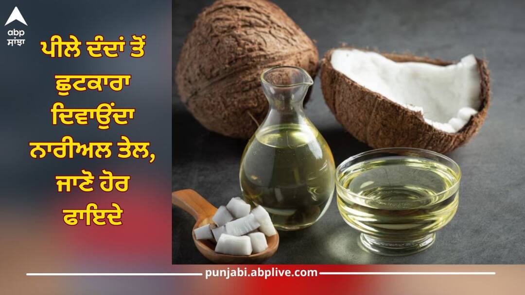 Coconut Oil: ਪੀਲੇ ਦੰਦਾਂ ਤੋਂ ਛੁਟਕਾਰਾ ਦਿਵਾਉਂਦਾ ਨਾਰੀਅਲ ਤੇਲ, ਨਾਲ ਹੀ ਦੂਰ ਹੁੰਦੀਆਂ ਇਹ 5 ਸਮੱਸਿਆਵਾਂ, ਜਾਣੋ ਵਰਤੋਂ ਦਾ ਸਹੀ ਤਰੀਕਾ Coconut oil to get rid of yellow teeth, as well as these 5 problems, know right way of use health news Coconut Oil: ਪੀਲੇ ਦੰਦਾਂ ਤੋਂ ਛੁਟਕਾਰਾ ਦਿਵਾਉਂਦਾ ਨਾਰੀਅਲ ਤੇਲ, ਨਾਲ ਹੀ ਦੂਰ ਹੁੰਦੀਆਂ ਇਹ 5 ਸਮੱਸਿਆਵਾਂ, ਜਾਣੋ ਵਰਤੋਂ ਦਾ ਸਹੀ ਤਰੀਕਾ