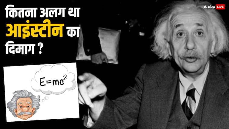 How did the great scientist Albert Einstein have the sharpest mind and what was his IQ level आम इंसान की तुलना में कैसे अलग था आइंस्टीन का दिमाग? रिसर्च में क्या आया था सामने