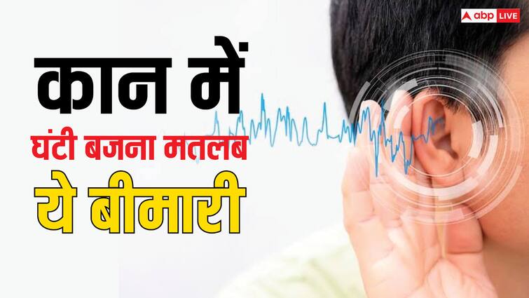 health tips what is tinnitus know treatment of ringing sound in ears Health Risk: क्या आपके कान में भी बजती है घंटी? हो सकती है ये खतरनाक बीमारी