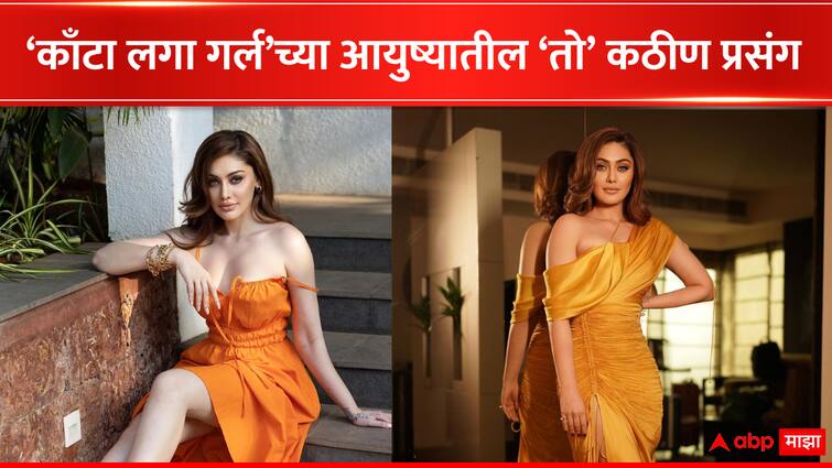 Kanta Laga girl Shefali Jariwala shared her bad phase personal life epilepsy Bollywood Entertainment Shefali Jariwala : 'बाल्कनीत उभी होते, जीवही गेला असता पण...', 'काँटा लगा गर्ल'च्या आयुष्यातली वेदनादायी प्रसंग