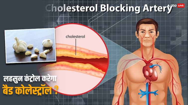 how to eat garlic to reduce cholesterol read full article in hindi Bad Cholesterol: बैड कोलेस्ट्रॉल को कंट्रोल करेगा लहसुन, जानिए इसे खाने का सही वक्त और तरीका