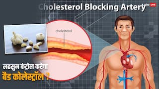 Bad Cholesterol: बैड कोलेस्ट्रॉल को कंट्रोल करेगा लहसुन, जानिए इसे खाने का सही वक्त और तरीका