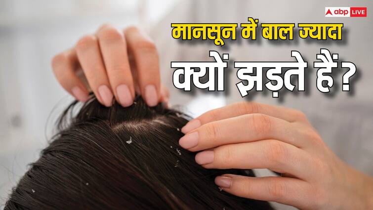 Why Hair Fall and Dandruff Problem Occurs During Monsoon? Know the Answer