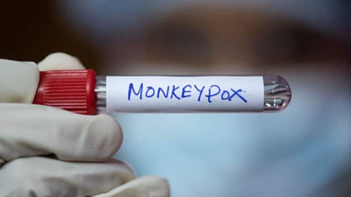 WHO के महानिदेशक टेड्रोस ने बताया कि वर्ल्ड हेल्थ ऑर्गेनाइजेशन मंकी पॉक्स जैसा संक्रमण न हो इसलिए उसे रोकने के लिए अफ्रीका के रोग नियंत्रण एवं रोकथाम केंद्रों के साथ मिलकर काम कर रहा है.