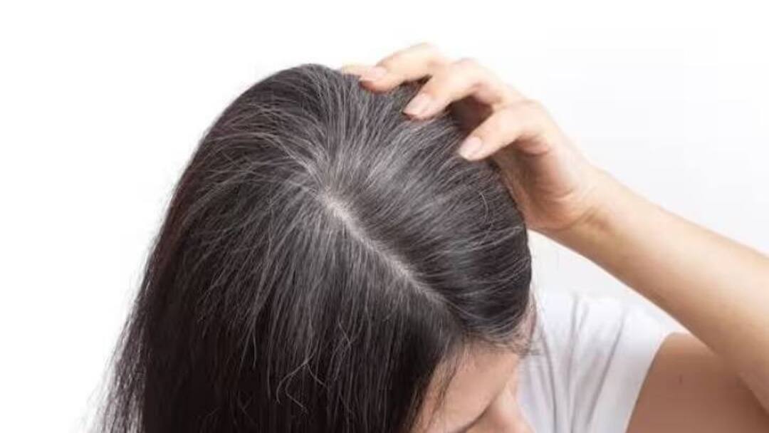 Premature White Hair Problem increase tension before marriage see solutions to keep your hairs black Hair Tips : लग्नाआधीच डोक्यावरील पांढऱ्या केसांनी टेन्शन वाढवलं? काळजी नको, करा फक्त 'हे' उपाय