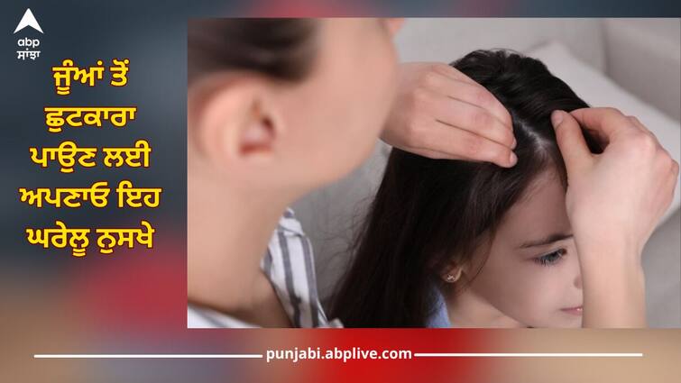 If children have head lice then try this home remedy, this problem will be removed Kids Health news Kids Health: ਜੇਕਰ ਬੱਚਿਆਂ ਦੇ ਸਿਰ 'ਚ ਜੂੰਆਂ ਤਾਂ ਅਜ਼ਮਾਓ ਇਹ ਘਰੇਲੂ ਨੁਸਖਾ, ਇਹ ਸਮੱਸਿਆ ਹੋ ਜਾਵੇਗੀ ਦੂਰ