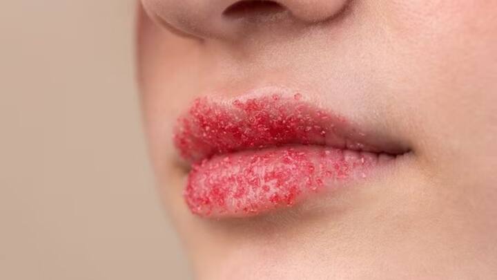 Lip Care Tips: ਜੇਕਰ ਤੁਹਾਡੇ ਬੁੱਲ ਕਾਲੇ ਅਤੇ ਫਟੇ ਹੋ ਗਏ ਹਨ ਤਾਂ ਤੁਸੀਂ ਇਸ ਘਰੇਲੂ ਲਿਪ ਸਕਰਬ ਦੀ ਵਰਤੋਂ ਕਰ ਸਕਦੇ ਹੋ। ਇਹ ਤੁਹਾਡੇ ਬੁੱਲ੍ਹਾਂ ਨੂੰ ਸੋਫਟ ਬਣਾਉਣ ਵਿੱਚ ਮਦਦ ਕਰੇਗਾ।