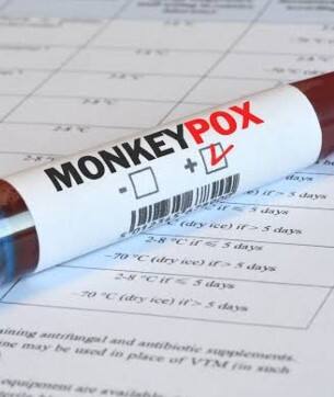 Monkeypox ਬਿਮਾਰੀ ਦੇ ਲੱਛਣ, ਜਾਣੋ ਕਿਵੇ ਕਰੀਏ ਬਚਾਅ