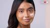 White Spot On Face: શરીર પર સફેદ ડાઘ આ ખતરનાક અને જીવલેણ રોગની નિશાની છે, આજે જ કરાવો આ ટેસ્ટ