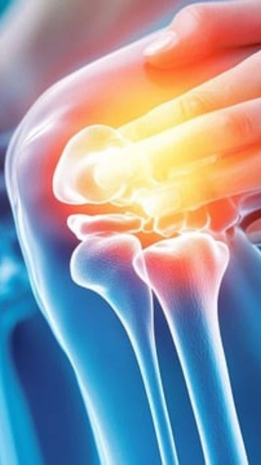 Arthritis Symptoms, Causes And Prevention: तरुणांमध्ये संधिवाताची वाढती समस्या; सुरुवातीची लक्षणं दुर्लक्षित केल्यात भोगावे लागतील गंभीर परिणाम, तज्ज्ञ सांगतात...