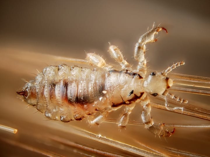 Chigo fleas are tiny insects that can lay eggs on your skin and spread. These pods penetrate the skin and cause itching and irritation. Their infestation can be serious, so it is important to remove them immediately.