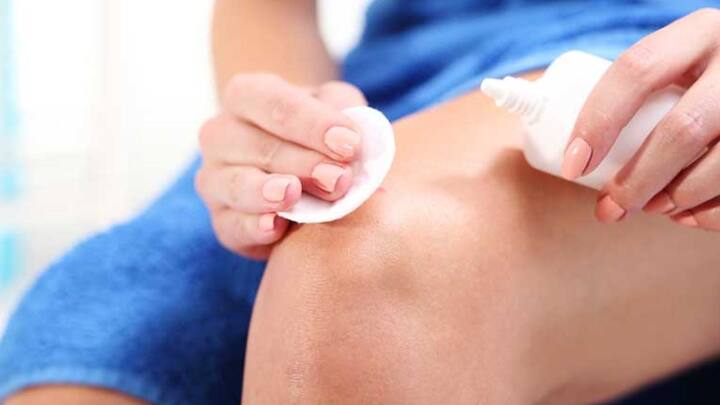 कुत्ता, बंदर या बिल्ली अगर आपको काट लेती है. तो काटने के तुरंत बाद आप अपने घाव को पानी से अच्छे से धो लें. इसके साथ ही साबुन से भी घाव को अच्छे से साफ कर लें. इससे रेबीज फैलने का खतरा कम हो जाता है.