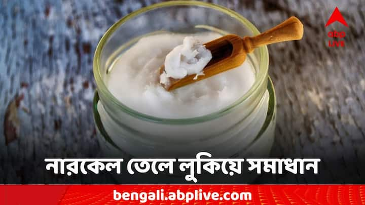 Lifestyle Tips: চুল সফট রাখে নারকেল তেল। একইসঙ্গে নতুন চুল গজাতেও সাহায্য করে। কীভাবে এই তেল মাখলে লম্বা হবে চুল?