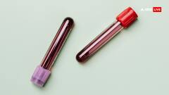 MP में सिकल सेल एनीमिया के 20 हजार से ज्यादा केस की पहचान, जनजाति बाहुल्य इलाकों में स्क्रीनिंग