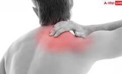 Back Pain: ਕੀ ਤੁਸੀਂ ਵੀ ਪਿੱਠ ਦਰਦ ਤੋਂ ਪਰੇਸ਼ਾਨ ਹੋ? ਜਾਣੋ ਲੱਛਣ ਅਤੇ ਕਾਰਨ