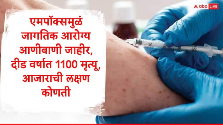 World Health Organization declared MPOX as World Health Emergency check details MPOX : दीड वर्षात हजारांपेक्षा अधिक मृत्यू, मुलांवरही संकट, MPOX किती धोकादायक, जाणून घ्या लक्षणं