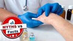 क्या जिंदगी में सिर्फ एक ही बार होता है मंकीपॉक्स? जानें इसका पूरा सच