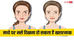 क्या आपके माथे पर भी दिख रही हैं नसें? जानें कैसे हो सकता है ये खतरनाक