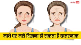 Forhead Veins: क्या आपके माथे पर भी दिख रही हैं नसें? जानें कैसे हो सकता है ये खतरनाक
