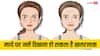 Forhead Veins: क्या आपके माथे पर भी दिख रही हैं नसें? जानें कैसे हो सकता है ये खतरनाक