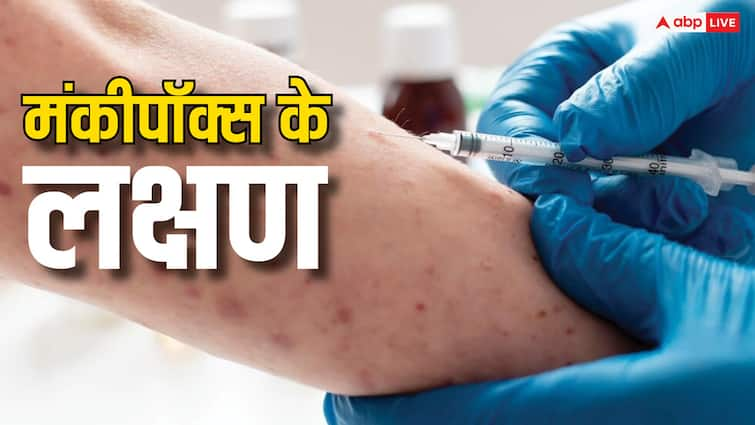 WHO declares monkeypox a public health emergency of global concern know about symptoms Monkey Pox: मंकीपॉक्स बन गया है ग्लोबल इमरजेंसी, जानें कैसे होती है ये बीमारी और क्या होते हैं इसके लक्षण