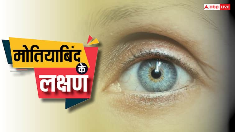 eye care tips cataract causes symptoms and treatment motiyabind ke lakshan in hindi Cataract Symptoms: मोतियाबिंद होने के बाद दिखते हैं ये बड़े लक्षण, इग्नोर करना पड़ सकता है भारी