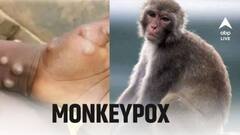 Monkeypox: कोरोना की तरह महामारी बनता जा रहा मंकीपॉक्स, अफ्रीका के बाहर भी मिल रहे मरीज; 100 से ज्यादा लोगों की हुई मौत
