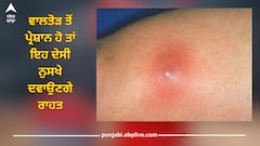 Health News: ਵਾਲਤੋੜ ਤੋਂ ਪ੍ਰੇਸ਼ਾਨ ਹੋ ਤਾਂ ਇਹ ਦੇਸੀ ਨੁਸਖੇ ਦਵਾਉਣਗੇ ਰਾਹਤ, ਦਰਦ ਅਤੇ ਸੋਜ ਤੋਂ ਮਿਲੇਗਾ ਛੁਟਕਾਰਾ