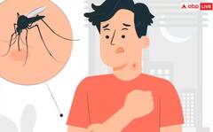 Dengue: ਡੇਂਗੂ ਤੋਂ ਬਚਣਾ, ਤਾਂ ਘਰ ਦੇ ਅੰਦਰ ਜਾਂ ਬਾਹਰ ਇਨ੍ਹਾਂ ਗੱਲਾਂ ਦਾ ਰੱਖੋ ਖਾਸ ਧਿਆਨ