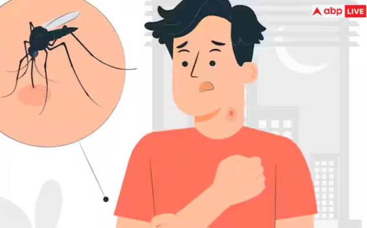 ਇਹ ਤੇਜ਼ੀ ਨਾਲ ਗੰਭੀਰ ਡੇਂਗੂ ਵਿੱਚ ਬਦਲ ਸਕਦਾ ਹੈ, ਜਿਸ ਨੂੰ ਡੇਂਗੂ ਹੈਮੋਰੈਜਿਕ ਫੀਵਰ ਜਾਂ ਡੇਂਗੂ ਸ਼ੌਕ ਸਿੰਡਰੋਮ ਵੀ ਕਿਹਾ ਜਾਂਦਾ ਹੈ, ਜਦੋਂ ਤੁਹਾਡੇ ਖੂਨ ਦੇ ਪ੍ਰਵਾਹ ਵਿੱਚ ਥੱਕੇ ਬਣਾਉਣ ਵਾਲੇ ਸੈੱਲਾਂ (ਪਲੇਟਲੇਟਸ) ਦੀ ਗਿਣਤੀ ਘੱਟ ਜਾਂਦੀ ਹੈ ਅਤੇ ਤੁਹਾਡੀਆਂ ਖੂਨ ਦੀਆਂ ਨਾੜੀਆਂ ਇੰਨੀਆਂ ਖਰਾਬ ਹੋ ਜਾਂਦੀਆਂ ਹਨ ਕਿ ਉਹ ਲੀਕ ਹੋਣ ਲੱਗ ਜਾਂਦੀਆਂ ਹਨ। ਇਸ ਨਾਲ ਸਦਮਾ, ਅੰਦਰੂਨੀ ਖੂਨ ਨਿਕਲਣਾ ਅਤੇ ਅੰਗ ਫੇਲ੍ਹ ਹੋ ਸਕਦਾ ਹੈ।