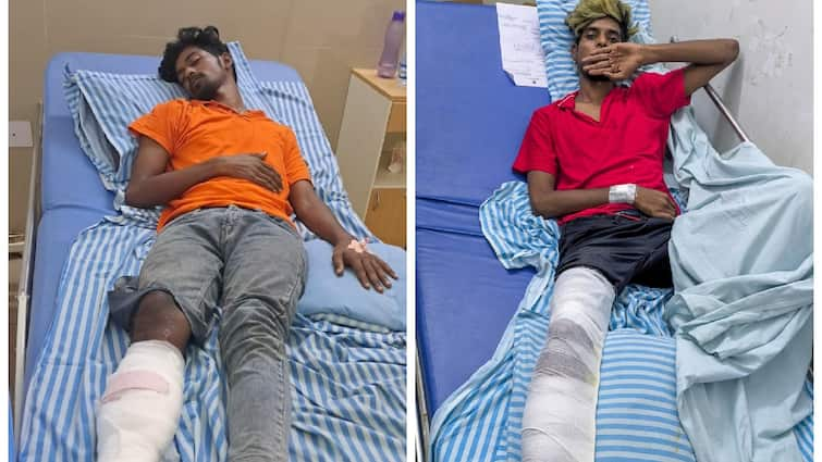 rowdies anti social elements coimbatore who tried to escape from the police were hospitalized with a broken leg Crime : போலீசிடம் இருந்து தப்பிச்செல்ல முயன்ற ரவுடிகள்.. மருத்துவமனையில் அனுமதி