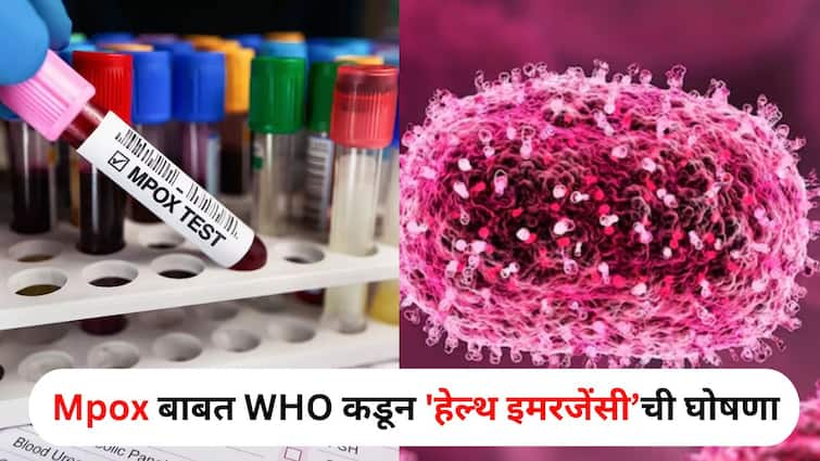 Mpox lifestyle marathi news Monkeypox threat Concern for India Health Emergency declared by WHO these things to remember Mpox : सावधान! मंकीपॉक्स हळूहळू पसरतोय..WHO कडून 'हेल्थ इमरजेंसीची' घोषणा, तुमच्या प्रश्नांची उत्तरं जाणून घ्या