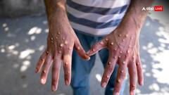 मंकीपॉक्स या कोरोना नहीं... इस बीमारी से सबसे ज्यादा डरते हैं भारत के लोग, सर्वे में हुआ बड़ा खुलासा