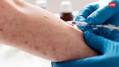 भारत में मंकीपॉक्स का कितना होगा असर, जानें क्या कहते हैं एक्सपर्ट्स