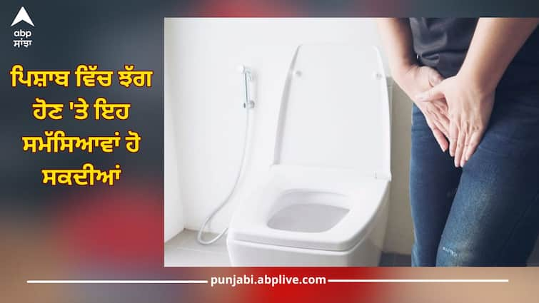 If there is a lot of foam while urinating, then understand that you have suffered from these diseases health news ਸਾਵਧਾਨ! ਜੇਕਰ ਪਿਸ਼ਾਬ ਕਰਦੇ ਸਮੇਂ ਆਉਂਦਾ ਜ਼ਿਆਦਾ ਝੱਗ ਤਾਂ ਸਮਝ ਲਓ ਤੁਹਾਨੂੰ ਹੋ ਗਈਆਂ ਇਹ ਬਿਮਾਰੀਆਂ