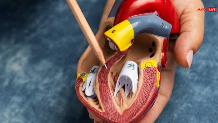 Angioplasty or Bypass Surgery What’s the Difference and When Do You Need Them एंजियोप्लास्टी और बायपास सर्जरी में क्या अंतर है? जानें कौन सा इलाज कब जरूरी है