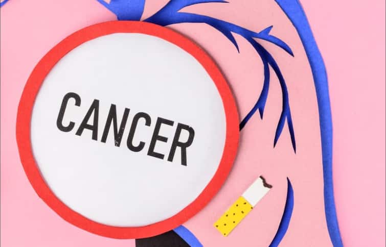 which-country-in-the-world-has-the-highest-number-of-cancer-cases-india-is-at-this-number-who-report-on-cancer General Knowledge: વિશ્વમાં કયા દેશમાં સૌથી વધુ કેન્સરના કેસો નોંધાય છે, આ નંબર પર છે ભારત