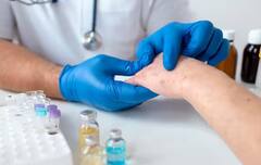 Monkeypox: મંકીપૉક્સથી ડરવાની કેટલી જરૂર, શું આ બીમારીથી થઇ શકે છે મોત?