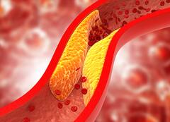 High Cholestrol 'ਚ ਜ਼ਹਿਰ ਤੋਂ ਘੱਟ ਨਹੀਂ ਆਹ ਚੀਜ਼ਾਂ, ਤੁਰੰਤ ਛੱਡਣ 'ਚ ਹੀ ਤੁਹਾਡੀ ਭਲਾਈ