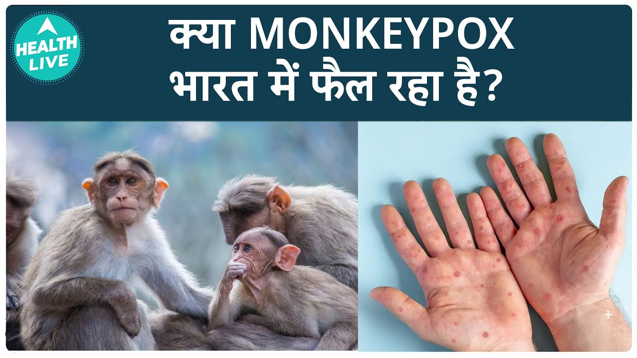 Modi Government Takes Action On Monkeypox | Health Live