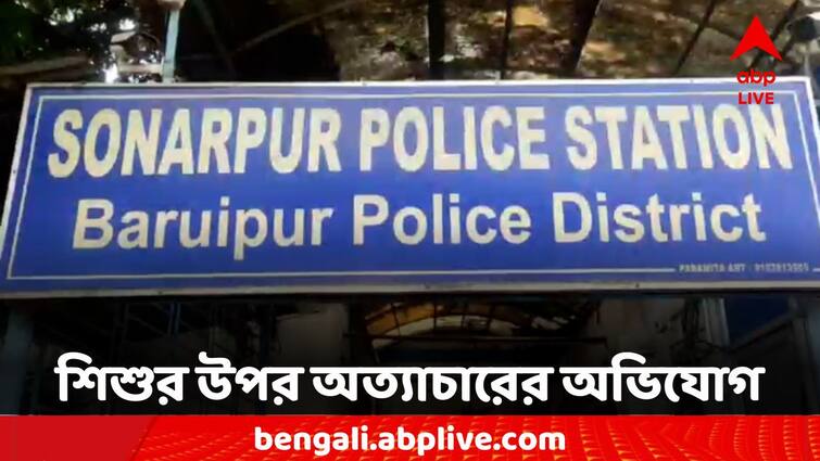 South 24 Parganas Sonarpur Allegation Child Injured Due to Torture By Family Member South 24 Parganas: সারা গায়ে সিগারেটের ছ্যাঁকা, একরত্তির উপর অত্যাচারের অভিযোগ মাসি-মেসোর বিরুদ্ধে